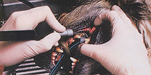 Ultrasonic Teeth Cleaning